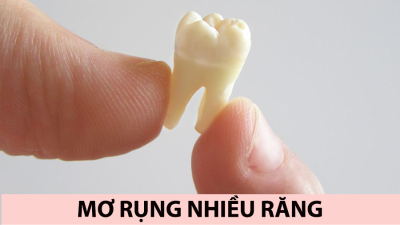 Nằm mơ thấy rụng răng đánh con số nào để tối ưu hoá tỷ lệ thắng?